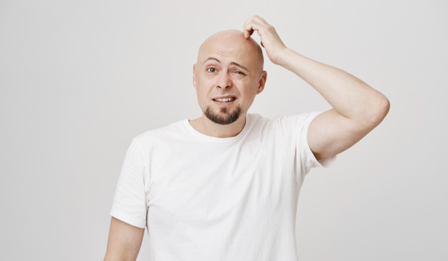 Shampo dan Serum Tidak Mempan Atasi Rambut Rontok? Coba Cara Tradisional untuk Cegah Kebotakan Dini