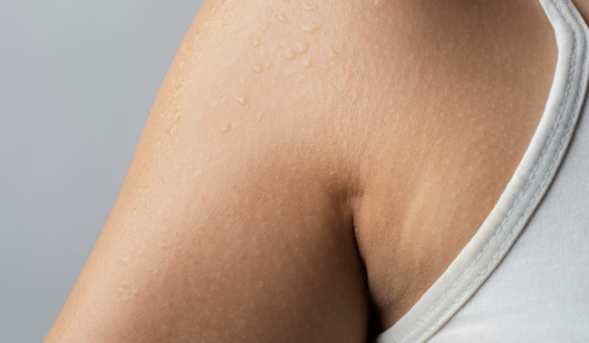 Cara Atasi Strech Mark, Garis Halus yang Tidak Berbahaya tapi Bikin Insecure