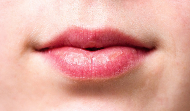 Simak, Ini Perbedaan Lip Balm dan Lip Serum untuk Skincare Bibir