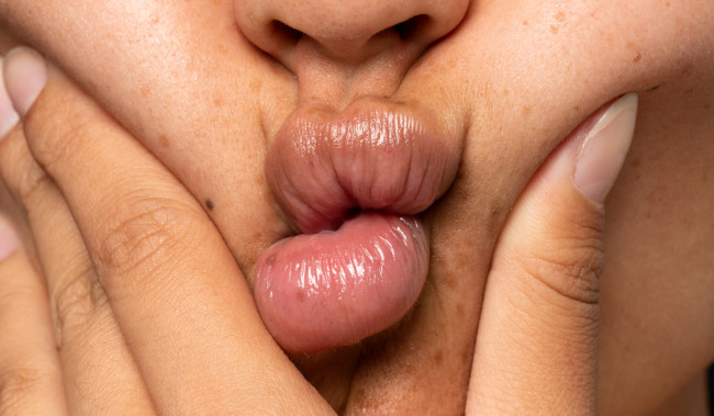 Penyebab dan Cara Hilangkan Bibir Hitam, Kulit Lebih Sehat serta Tampil Percaya Diri