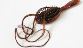 ATASI RAMBUT RONTOK - Ada beberapa hal yang sebabkan rambut rontok, beberapa cara dapat dilakukan untuk atasi rambut rontok. - Foto ilustrasi Pixabay/pimnana.