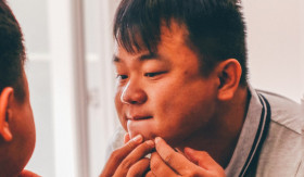 ACNE PATCH - Seringkali orang-orang menggunakan acne patch untuk atasi masalah jerawat, tapi apakah itu mitos atau fakta? - Foto ilustrasi Pixabay/streetwindy.