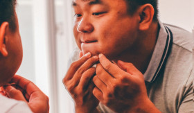 JERAWAT – Cara mengatasi kulit jerawat hormonal yang tepat. Lakukan langkah-langkah yang disarankan dr. Kamilah Jaidi. – Foto ilustrasi Pixabay/ streetwindy