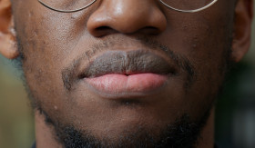BIBIR HITAM - Bibir hitam bisa disebabkan oleh berbagai penyebab, penting sekali bagi kamu untuk menghindari kebiasaan buruk ini. - Foto ilustrasi freepik/DC Studio.