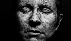 HIDROKUINON - Segera berhenti dari penggunaan skincare yang mengandung hidrokuinon dan merkuri. - Foto ilustrasi Pixabay/designundfotoart.