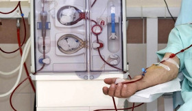 PASIEN ANAK CUCI DARAH DI RSCM - Fakta dibalik kabar anak-anak yang cuci darah di RSCM. - Foto dok.siloamhospitals.com.