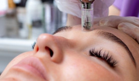 TIPS- Microneedling vs. Laser: Pilih Mana untuk Hasil Maksimal dan Cepat? (Sumber: https://www.alodokter.com/)