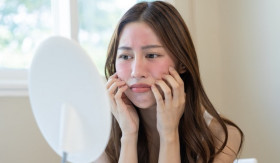 KESEHATAN KULIT- Sunburn di Tempat Dingin? Begini Penjelasan dan Pentingnya Sunscreen untuk Melindungi Kulit (Sumber: https://www.alodokter.com/)
