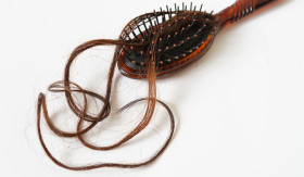 ATASI RAMBUT RONTOK - Rambut rontok bagi wanita berhijab, adalah masalah yang sering dialami. Lakukan cara ini agar akar rambut kembali kuat. - Foto ilustrasi Pixabay/pimnana.