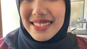 TIPS- Hindari Menjilat Bibir! Berikut 7 Cara Agar Bibir Tetap Sehat (Ulfah Wafa Almubarokah/ ayobacaners.com)