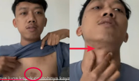 WHITE TOMATO DOKTER RICHARD - Seorang pria bagikan review usai rutin konsumsi white tomato Dokter Richard Lee. - Foto tangkap layar YouTube/Nononon.
