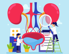 Ilustrasi batu ginjal. Menurut Guru Besar Urologi Kedokteran UI, pola hidup sedentari dan obesitas memicu batu ginjal. Ilustrasi/Freepik.
